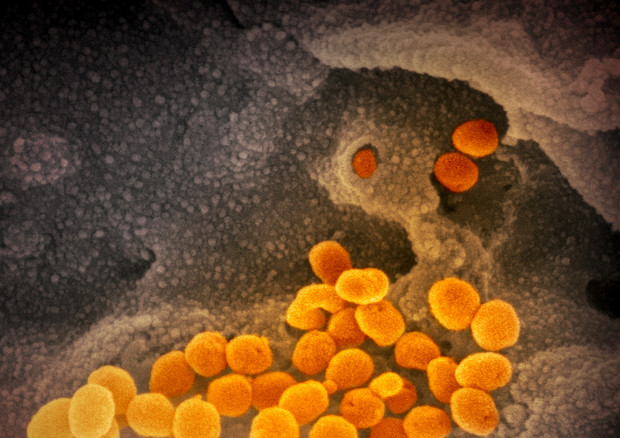 coronavirus | Un vaccino sviluppato in Italia è capace di generare anticorpi coronavirus | Un vaccino sviluppato in Italia è capace di generare anticorpi